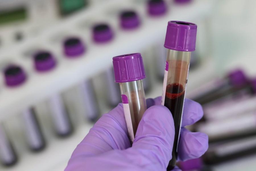 Test tubes with blood