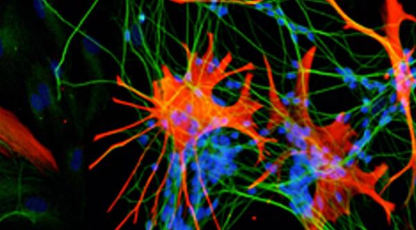 Astrocyte image