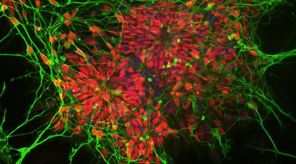 clusters of new neurons