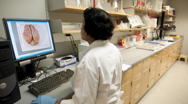 A researcher looking at an image of a brain