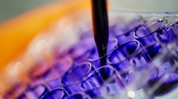A pipette and glass beakers in a lab setting