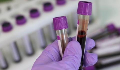 Test tubes with blood inside.